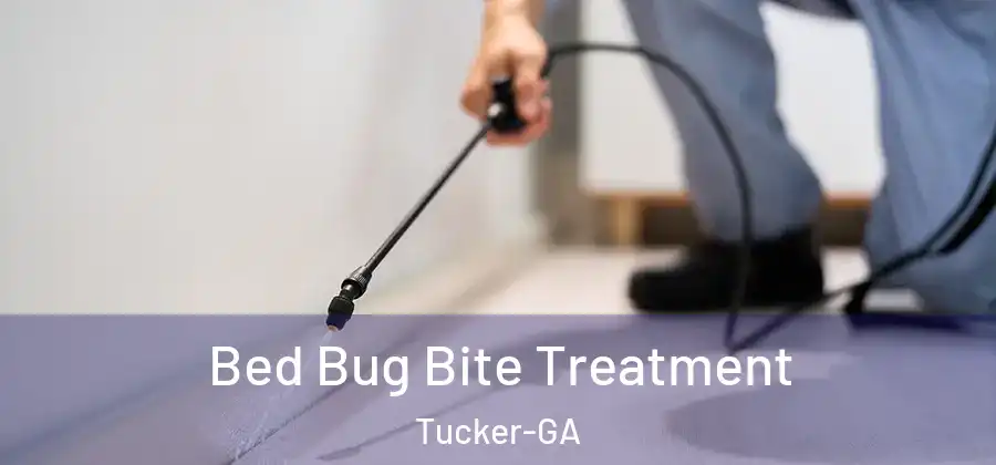 Bed Bug Bite Treatment Tucker-GA